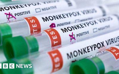 Over 100,000 monkeypox vaccines procured, government says